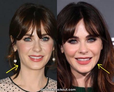 zooey deschanel filler|Zooey Deschanel: Before and After